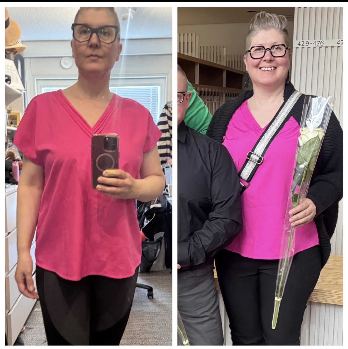 Amandan ennen- ja jälkeen-kuvat vierekkäin.